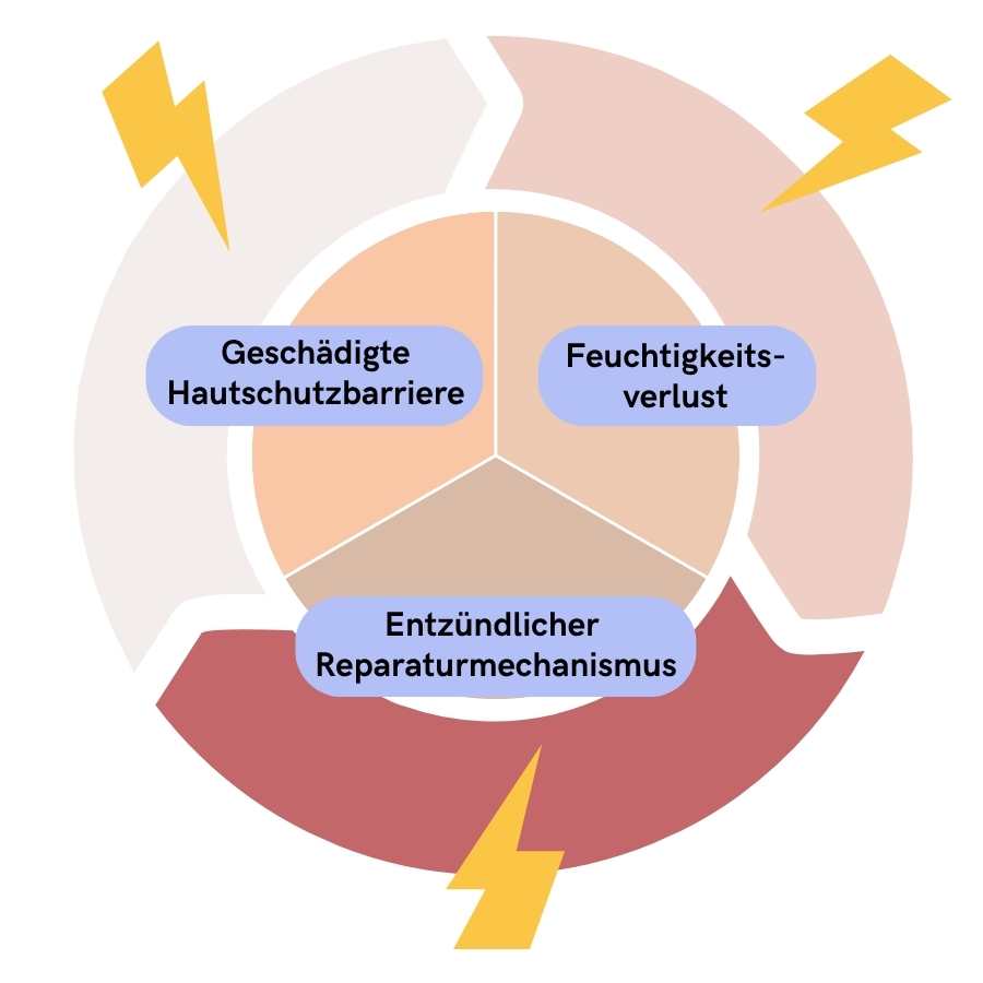 Illustration des Teufelskreises einer geschädigten Hautschutzbarriere, adulte Akne, hormonelle Akne