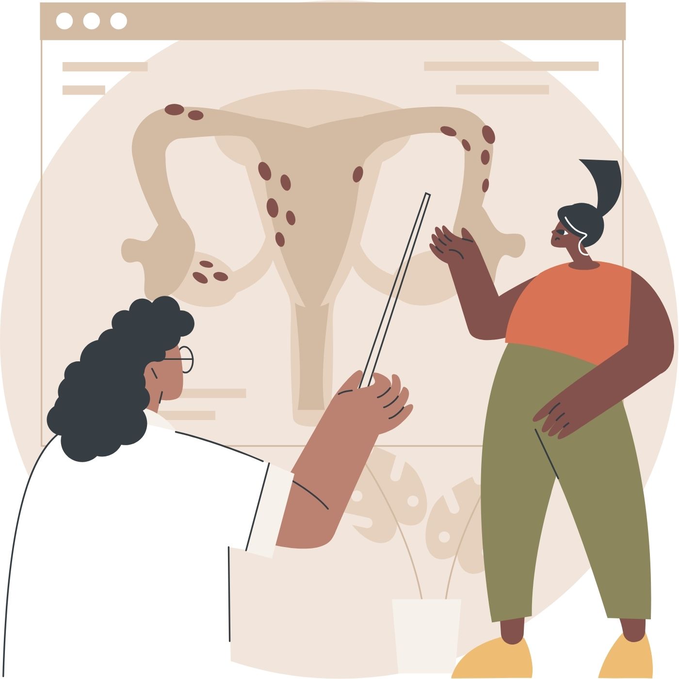 Illustration Ovar und Gebärmutter mit Endometrioseherden, zwei weiblich gelesene Figuren zeigen auf die Abbildung