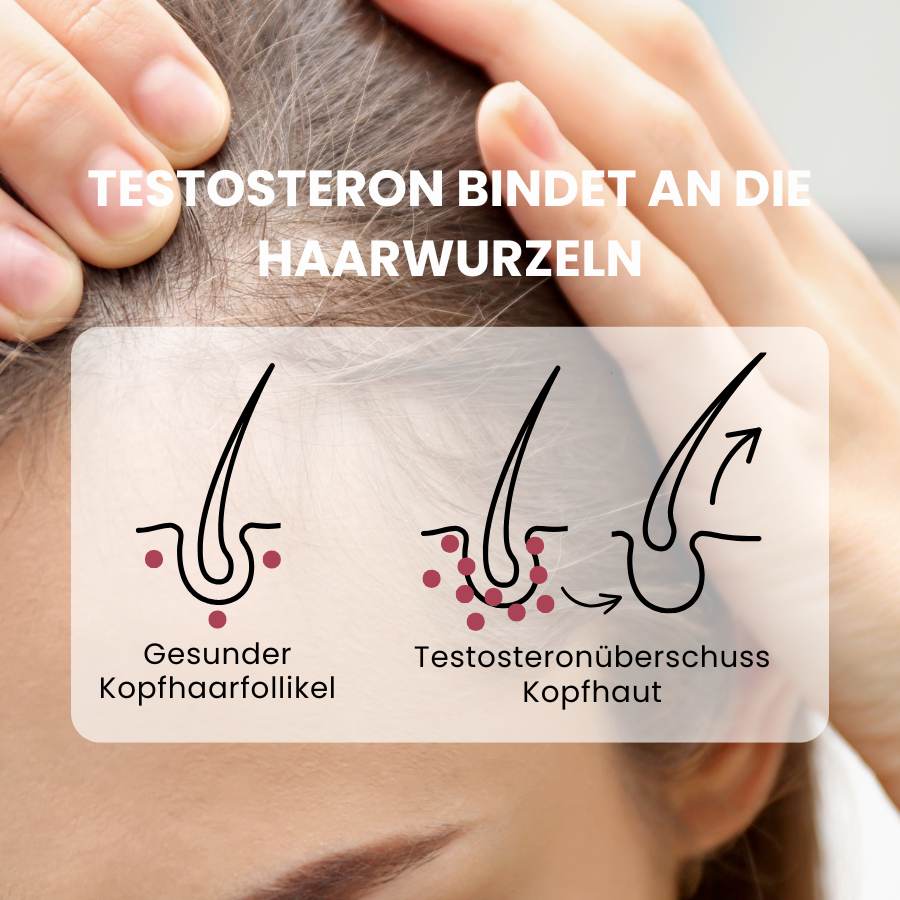 Wirkungsweise von fenou beauty bei Androgenüberschuss an Haarfollikel